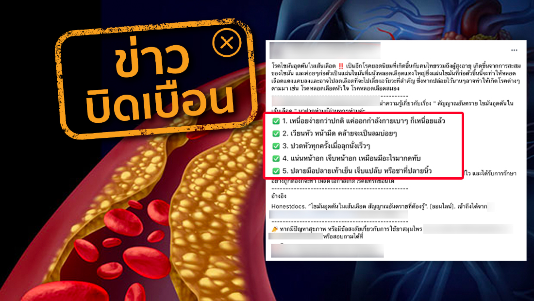 ผลิตภัณฑ์ Accuvistum ช่วยรักษาผู้ที่สูญเสียการได้ยิน หูหนวก โดยไม่ต้องผ่าตัด