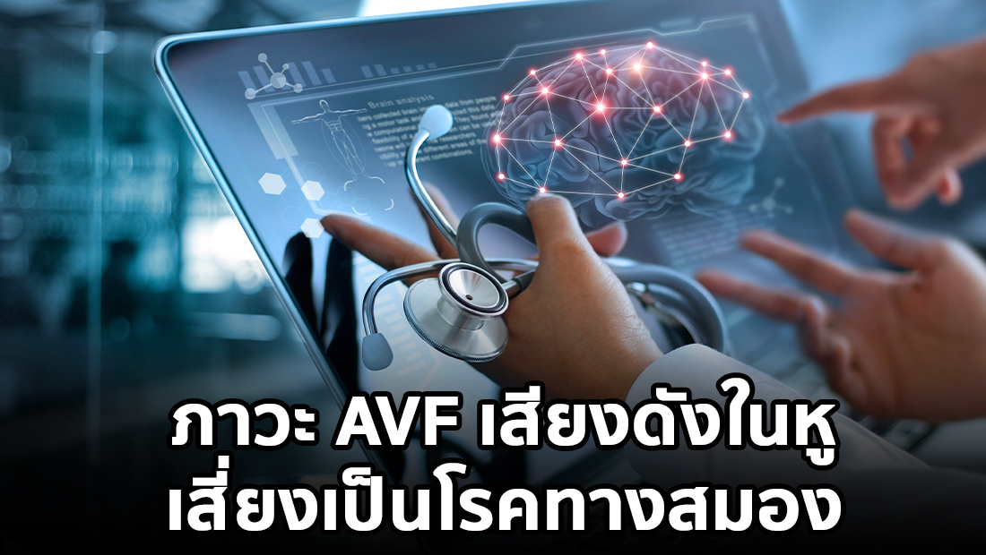 ภาวะ AVF เสียงดังในหู เสี่ยงเป็นโรคทางสมอง จริงหรือ?